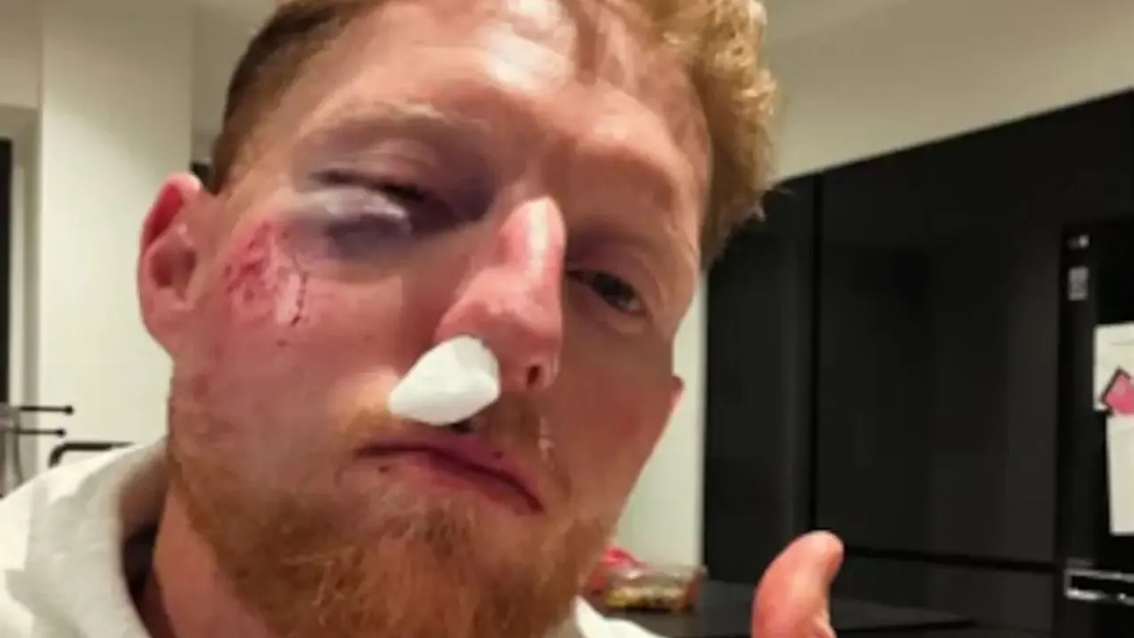 Ben Stokes traumatised after facial smash, vows helmet rule for life